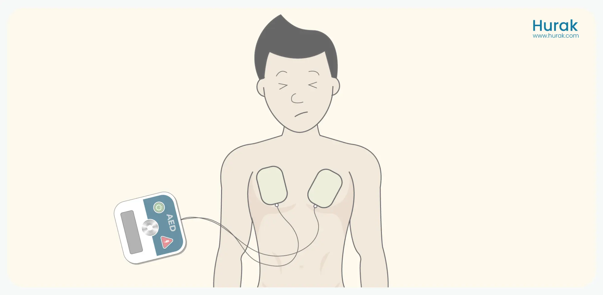 Defibrillation