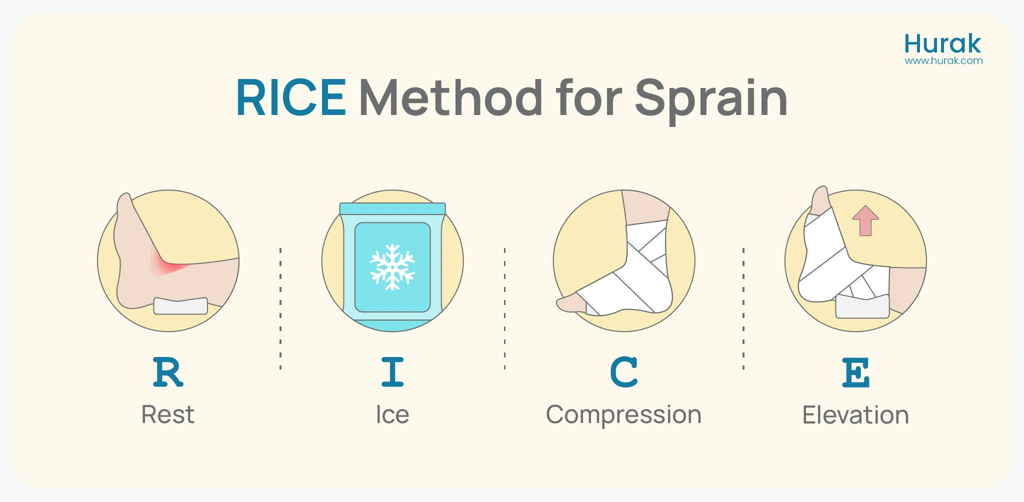 RICE Method for Sprain