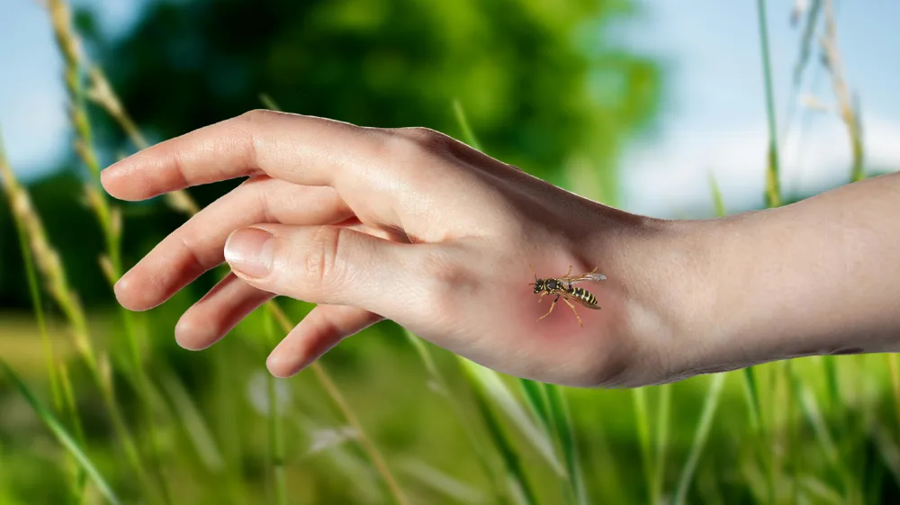 Wasp Sting