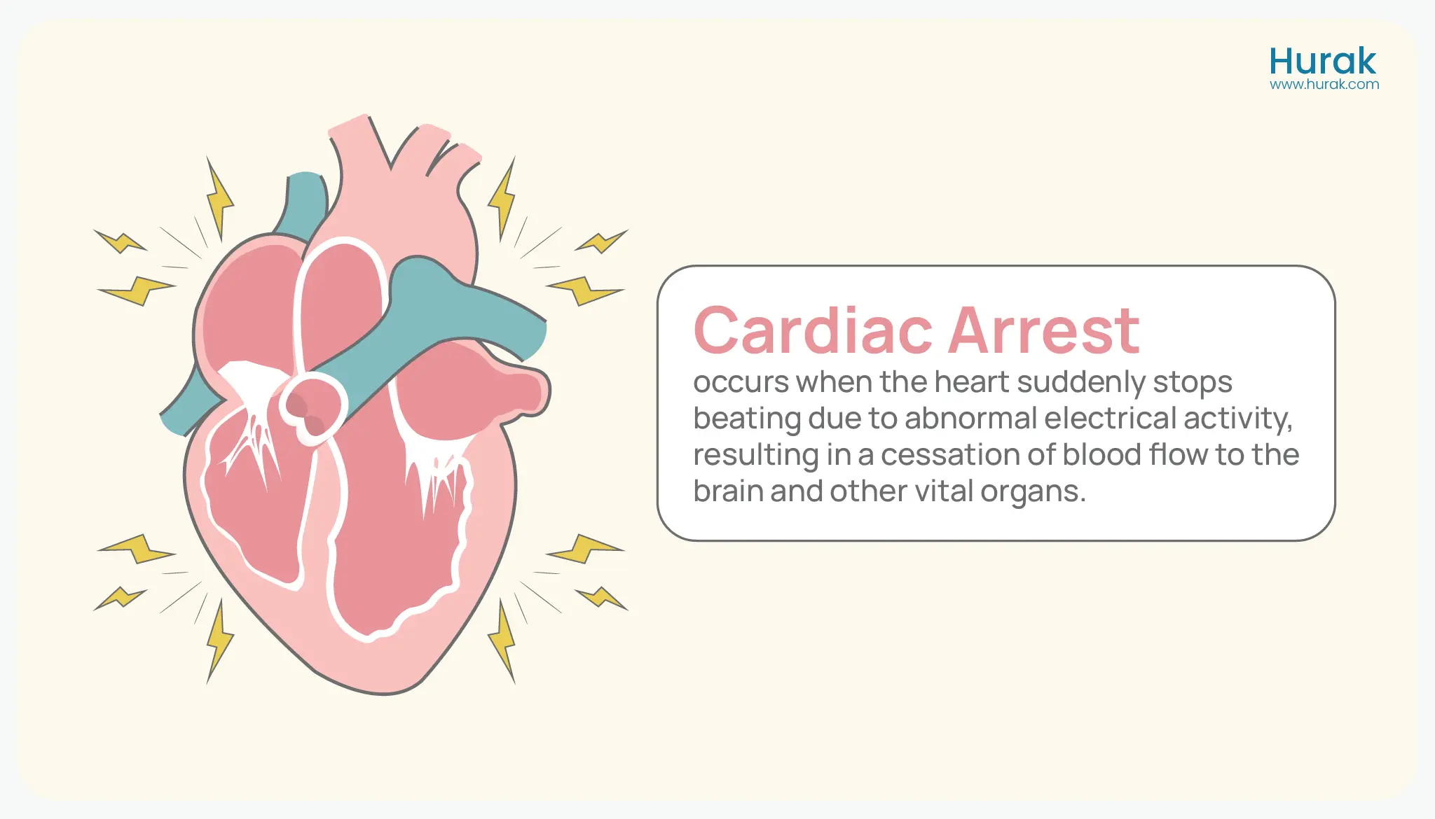 What is a Cardiac Arrest