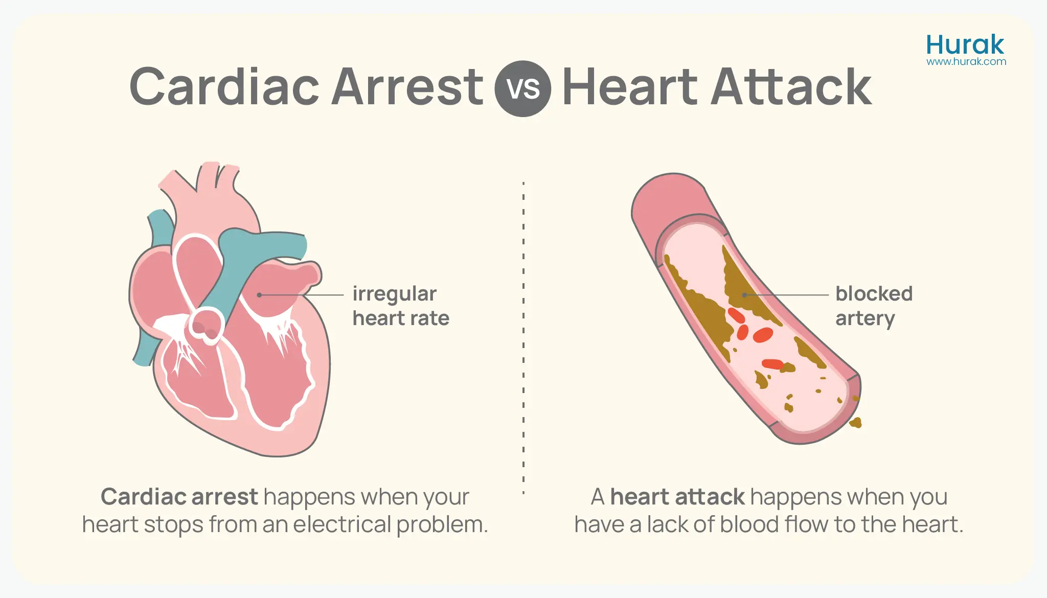 cardiac arrest vs heart attack
