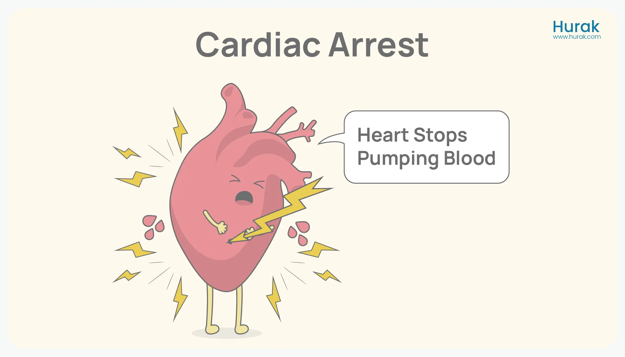 cardiac arrest
