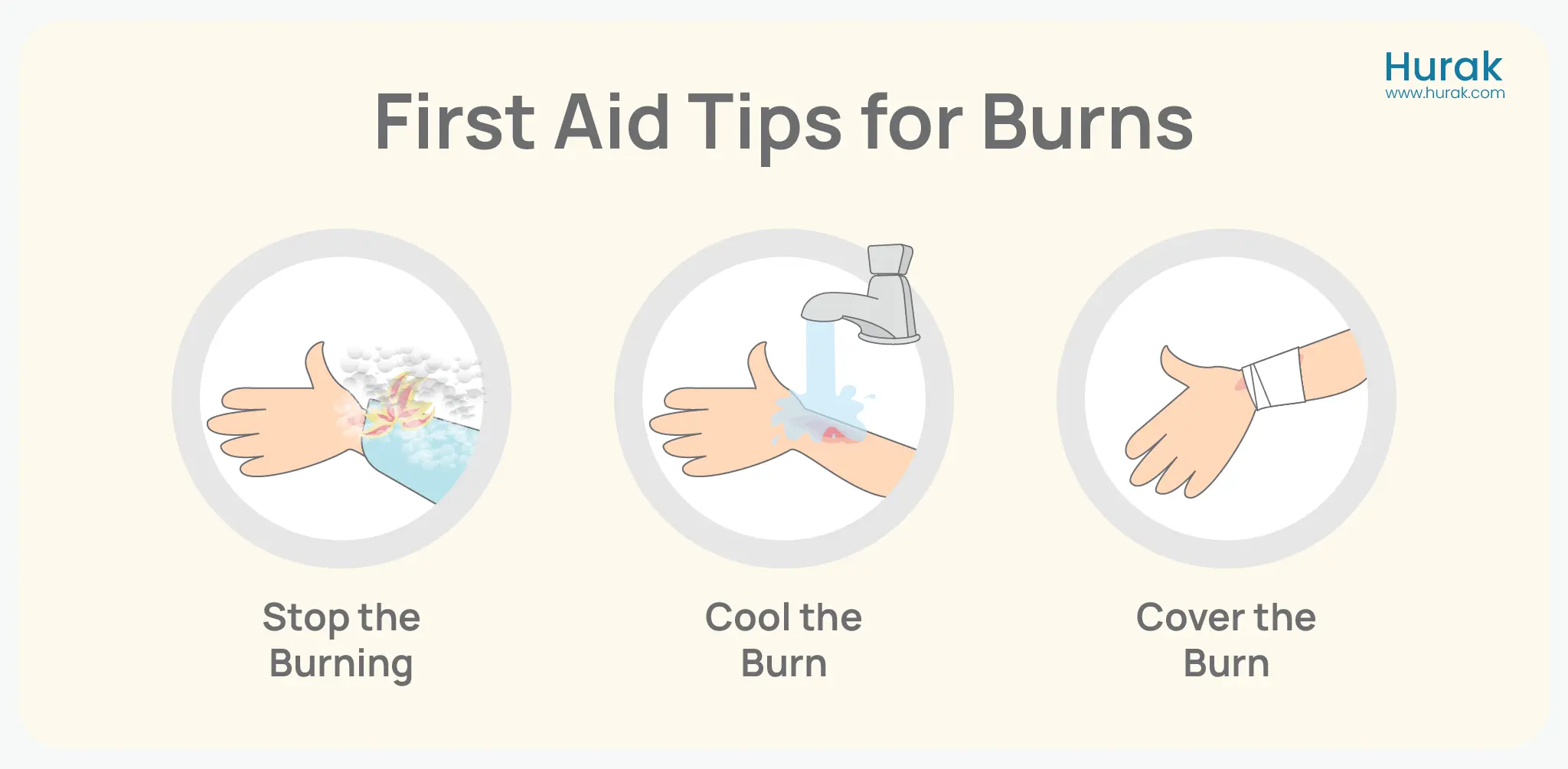 first aid tips for burn