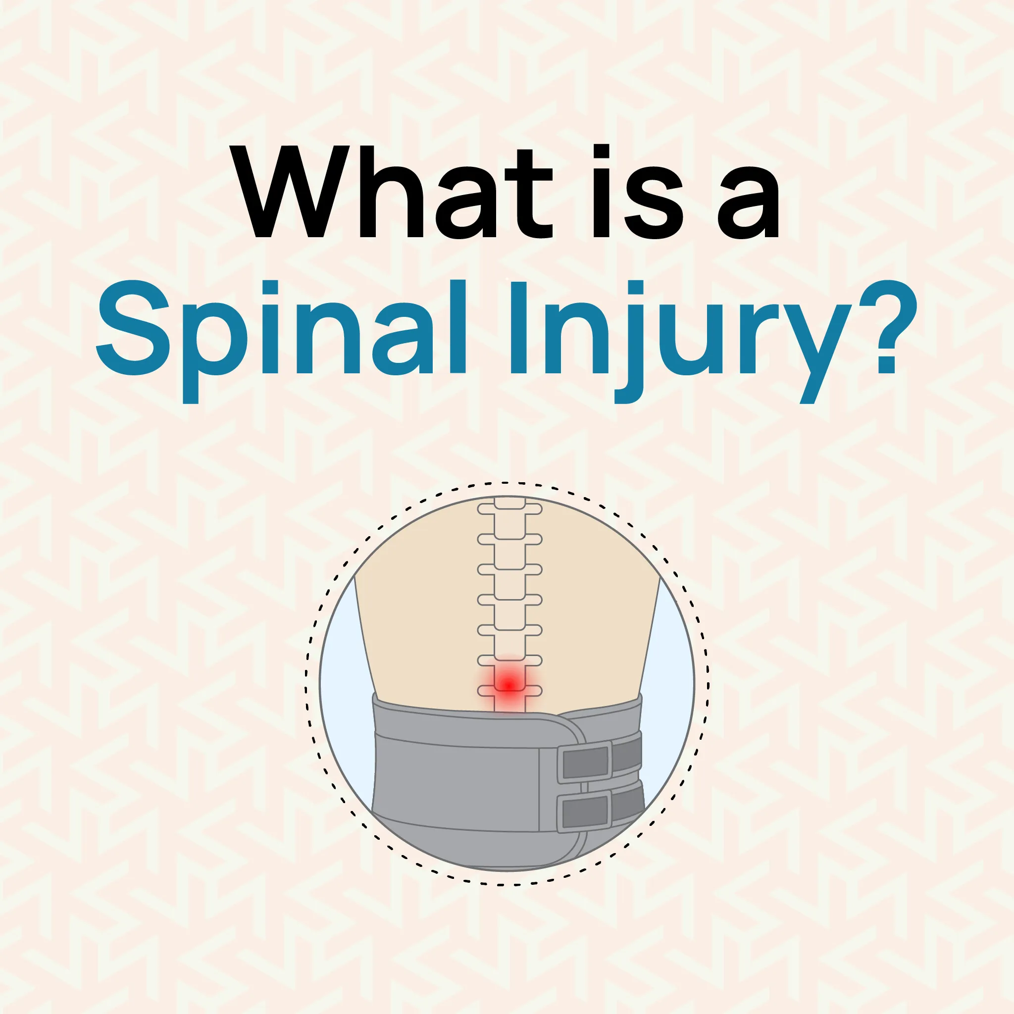 what-is-a-spinal-injury