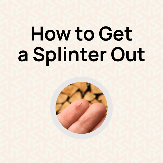 How to Get a Splinter Out