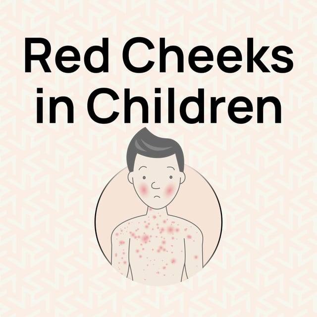 red-cheeks-in-children-uk-guide-hurak