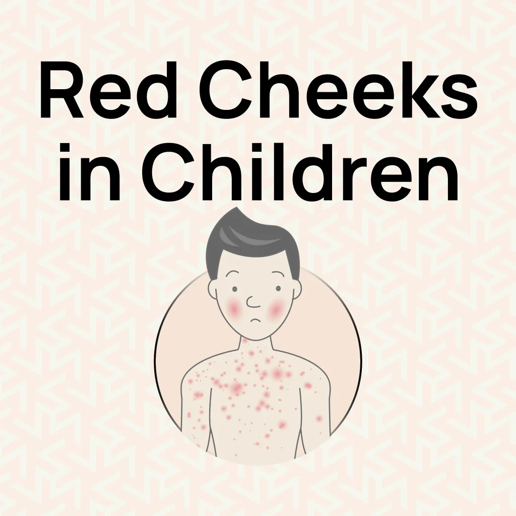 Red Cheeks in Children Infographics