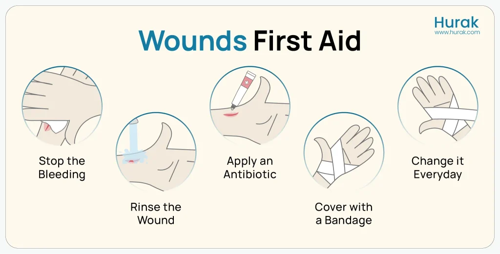 Visual representation of how to treat a cut and when to seek medical help